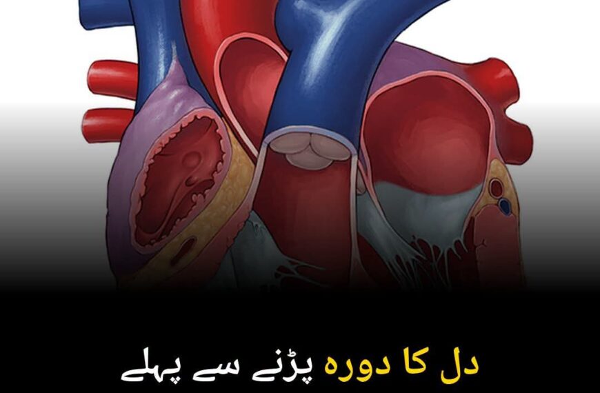 دل کا دورہ پڑنے سے پہلے موت کا خطرہ 20 فیصد کم۔۔